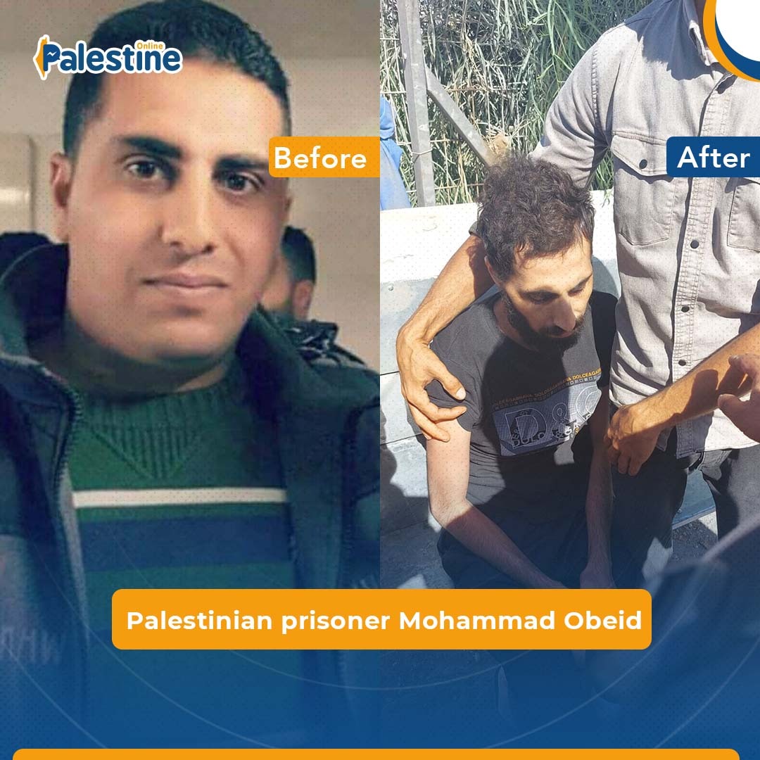 This is Palestinian prisoner Mohammad Obeid, who was released by Israeli occupation today after 18 months of detention, before and after his detention.
His family confirmed that their son didn't suffer from any health problems before the arrest.