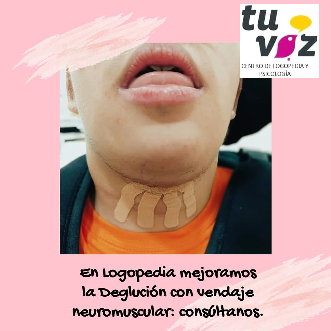 centrotuvoz's tweet image. #logopedia #motricidadorofacial  #vendaje #vendajeneuromúscular #kinesiotape #logopediamadrid #Fuenlabrada #centrotuvoz