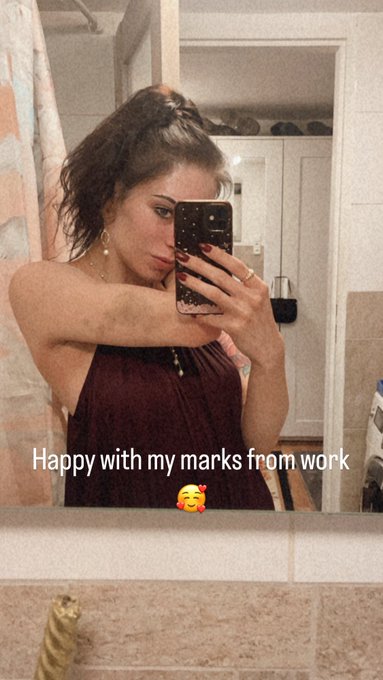 When you do a lot of stunts. 😅 https://t.co/gdJShXrGOd<a href="/tag/bts"class="tags"><span>#bts</span></a>