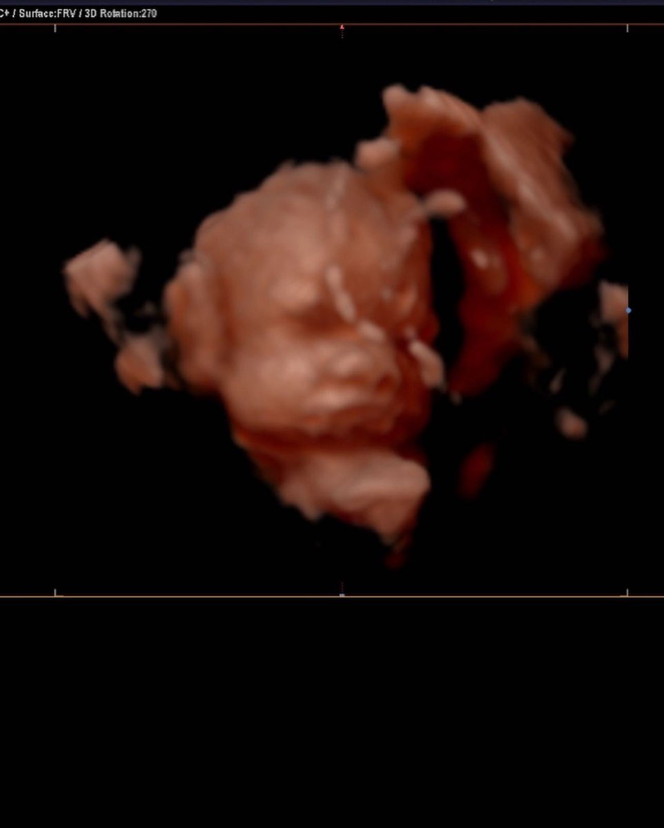 pmitchh_'s tweet photo. our handsome boy iโm so ready to meet you & have you in my arms!
your mama & daddy are so very excited to see youโre sweet face ๐๐โจ
#5moreweeks https://t.co/gyVJDMUGZR