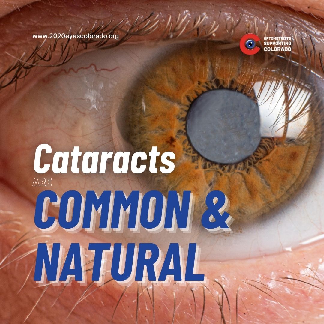 Vista Eye Care on Twitter "Cataracts are a common eye disease get