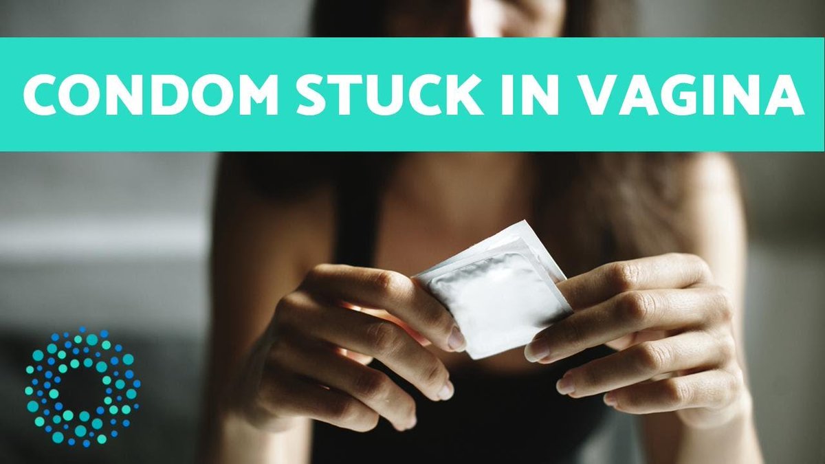 kateebashaban's tweet photo. IF A CONDOM GETS STUCK INSIDE, WHAT CAN YOU DO?
1/7
For starters, take comfort in knowing that it’s not in there forever, nor does the condom itself pose an immediate health risk so no need to panic.

RT thread for awareness https://t.co/Kj6FL0yEPi