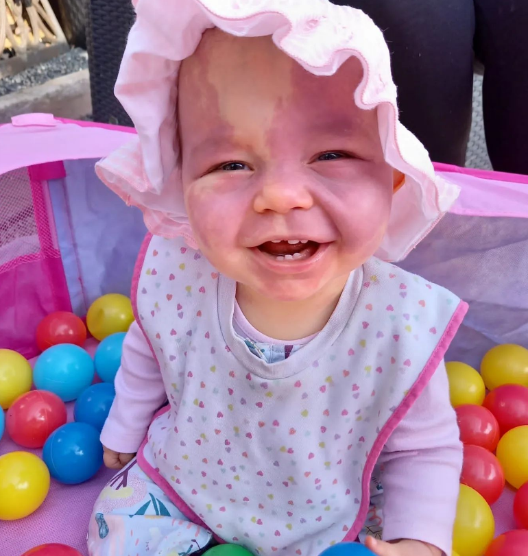 FaceEquality's tweet photo. "We will always raise Lily to know that she is beautiful. We will teach her that 'if everyone looked the same, the world would be a boring place.'" 

Lily's story: https://t.co/HOL8xOAVJo https://t.co/u48tfyb8Nw
