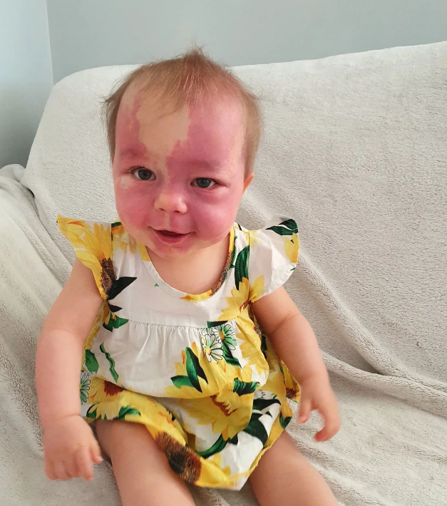 FaceEquality's tweet photo. "We will always raise Lily to know that she is beautiful. We will teach her that 'if everyone looked the same, the world would be a boring place.'" 

Lily's story: https://t.co/HOL8xOAVJo https://t.co/u48tfyb8Nw