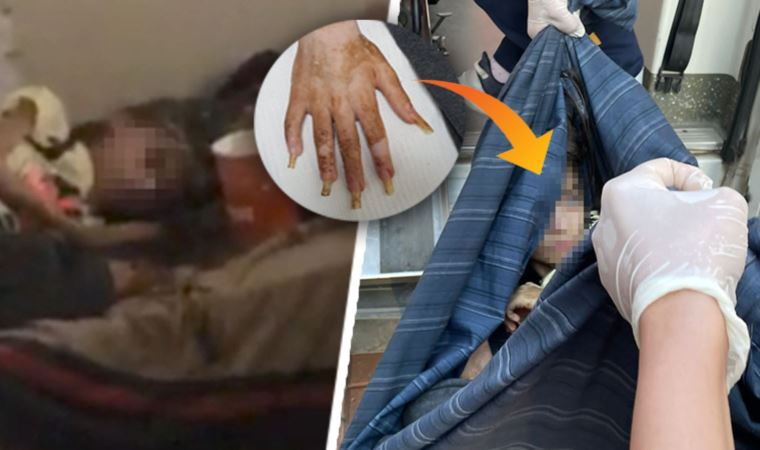 cumhuriyetgzt1's tweet photo. Sağlık durumuna ilişkin açıklama geldi

Bursa'daki çöp evde bulunan küçük Cem'in ilk sözleri ortaya çıktı
https://t.co/UnKt2D2tCZ https://t.co/srGmkDmw5z