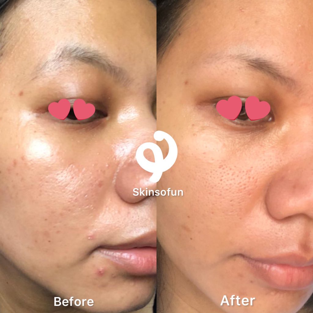 Chan on Twitter "Rekomendasi Gentle Facial Wash untuk kulit sensitif