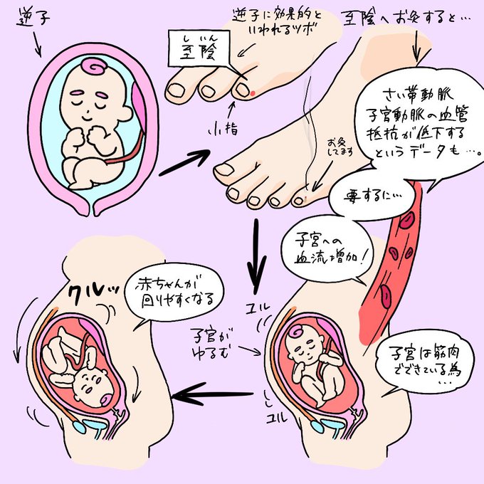 逆子 のイラスト マンガ コスプレ モデル作品 3 件 Twoucan