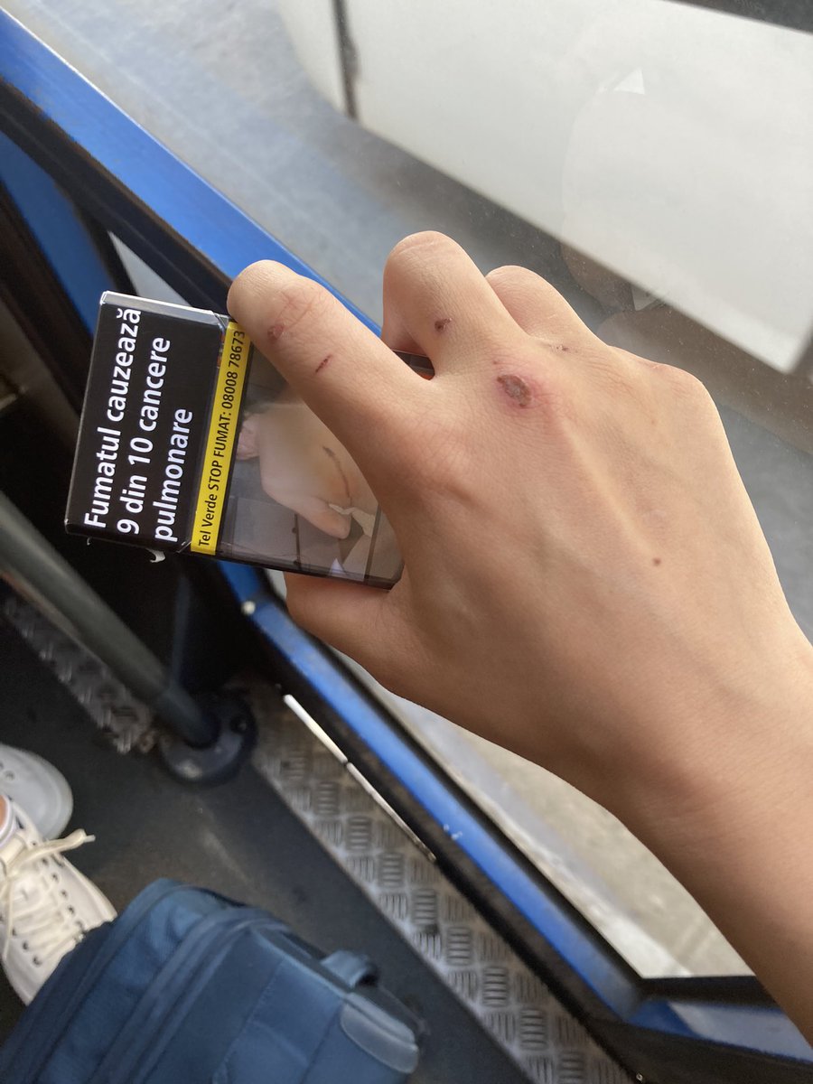 AndrasAlessa's tweet photo. Romanian tobacco and scars from a fight with a guy who spit in my face for not giving him money https://t.co/L7F0Zk5Mfi