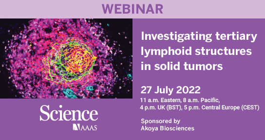 aaas's tweet photo. It's not too late!
Join #ScienceWebinars Wednesday at 11 am ET for: "Investigating tertiary lymphoid structures in solid tumors."
Register now: https://t.co/liZOhI7YE5
#Webinar #CancerResearch #LymphoidStructures https://t.co/gYGEKVfAV9