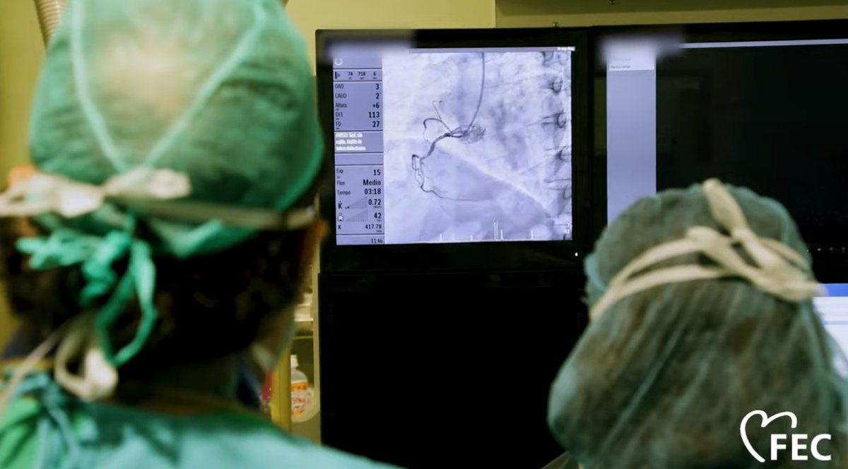 ¿Cómo se realiza el cateterismo diagnóstico? ¿En qué casos está indicado? El Dr. Manuel Pan, jefe del Servicio de Cardiología de <a href="/HUReinaSofia/">Hospital Universitario Reina Sofía</a>, lo explica en este vídeo: fundaciondelcorazon.com/corazon-facil/…