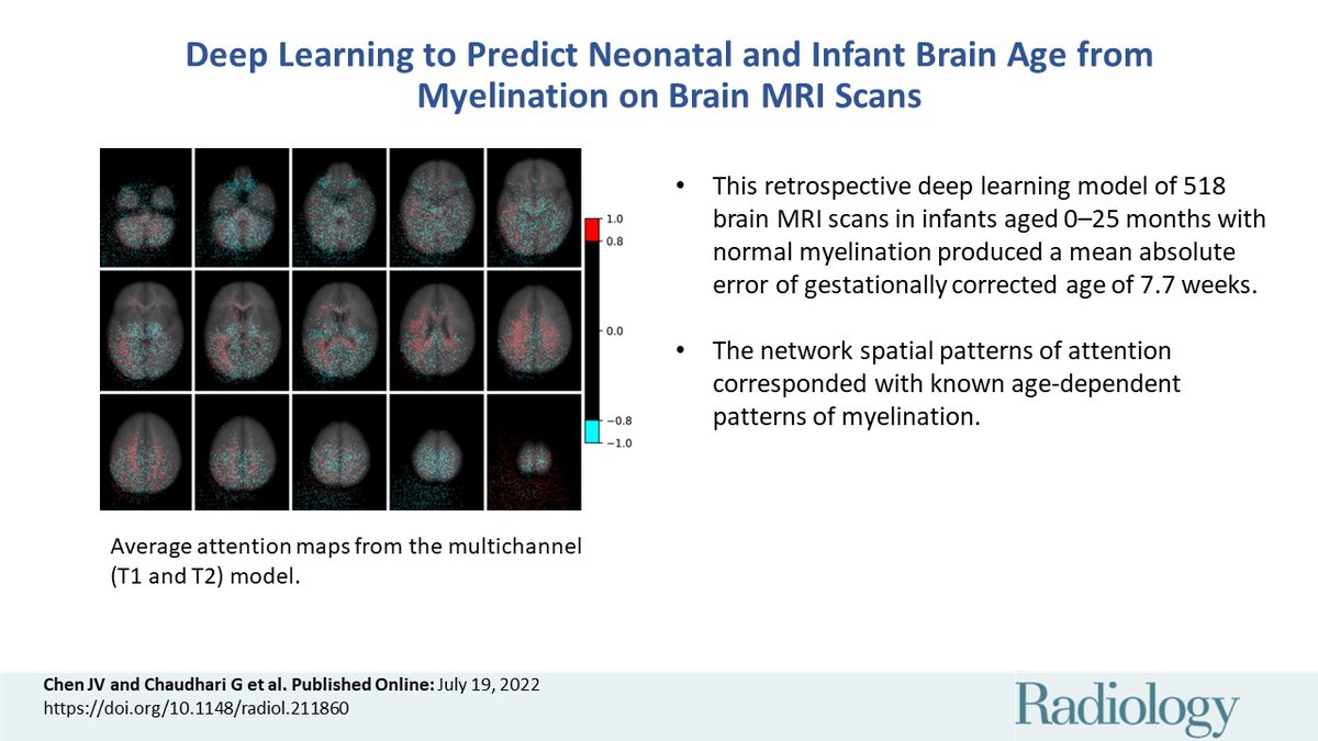 Radiology (@radiology_rsna) on Twitter photo A deep learning model evaluating myelination patterns predicted gestationally corrected age of neonates and infants based on brain MRI scans. <a href="/joshuavchen/">Joshua Chen</a> <a href="/gunvant_c/">Gunvant Chaudhari</a> <a href="/NeuroDx/">Christopher Hess</a> <a href="/DrDreMDPhD/">Andreas Rauschecker</a> <a href="/YiLiMD/">Yi Li</a> <a href="/UCSFimaging/">UCSF Imaging</a> <a href="/UCSF_Ci2/">UCSF Center for Intelligent Imaging</a> bit.ly/3OiJJlZ A deep learning model evaluating myelination patterns predicted gestationally corrected age of neonates and infants based on brain MRI scans. <a href="/joshuavchen/">Joshua Chen</a> <a href="/gunvant_c/">Gunvant Chaudhari</a> <a href="/NeuroDx/">Christopher Hess</a> <a href="/DrDreMDPhD/">Andreas Rauschecker</a> <a href="/YiLiMD/">Yi Li</a> <a href="/UCSFimaging/">UCSF Imaging</a> <a href="/UCSF_Ci2/">UCSF Center for Intelligent Imaging</a> bit.ly/3OiJJlZ