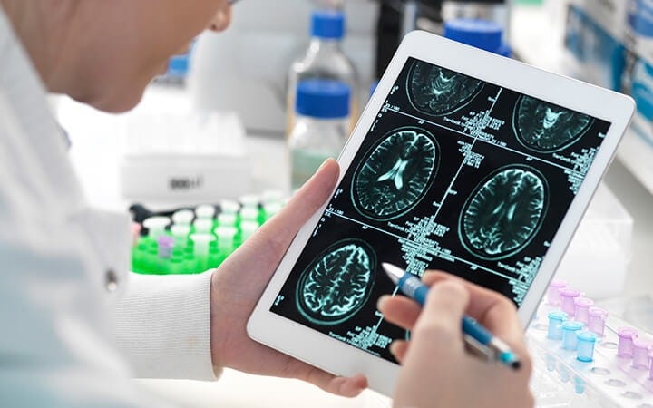 UH_CRC's tweet photo. Continued Alzheimer's research @HarringtonDI_UH
has shown promise with hopes of treatment for the disease in the near future. 

Click the link below to learn more about this fascinating discovery! 
https://t.co/CWJkMl6K1t

#DiscoverWithUH  #ResearchinCLE  #ClinicalResearch https://t.co/ran3YB3QRa
