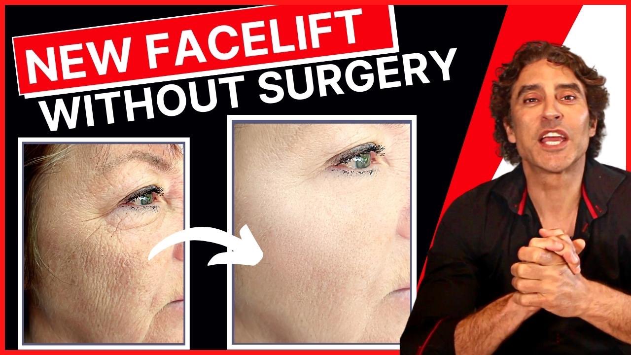 Face lift without surgery