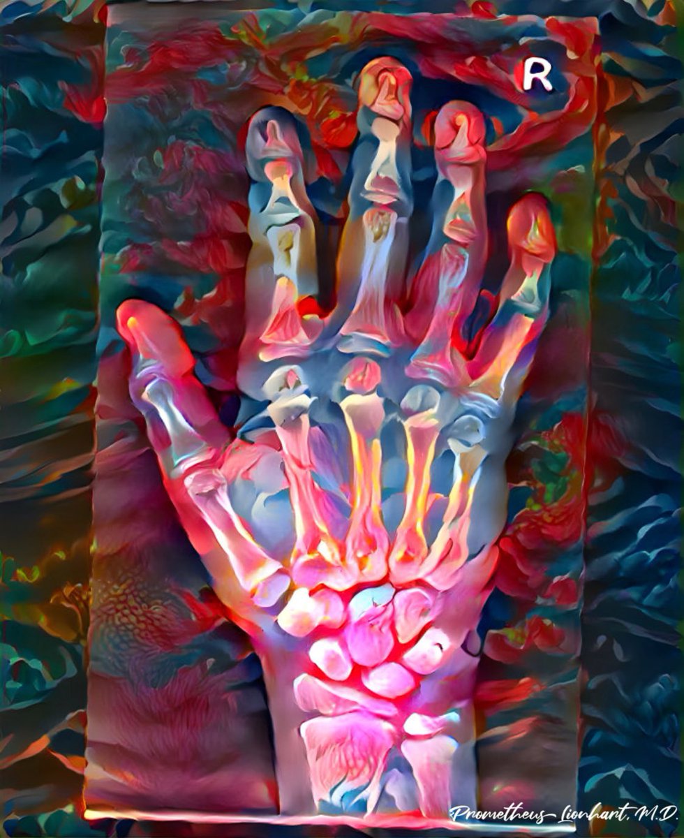 #radiology #medicalart #medicine #illustration #artoflionhart