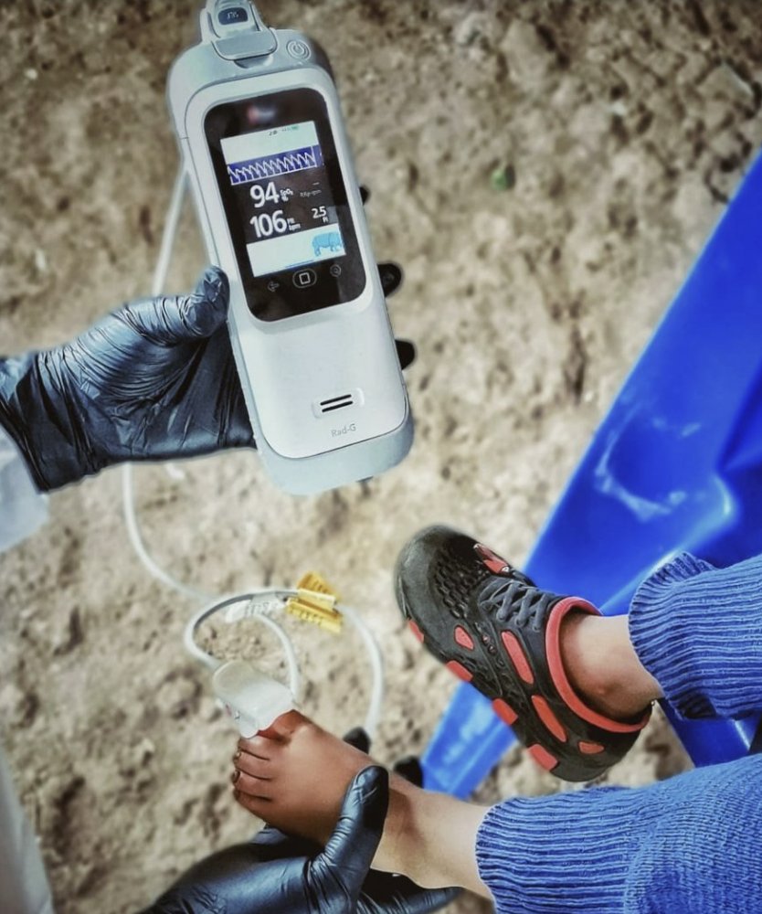 🙏 <a href="/Masimo/">Masimo</a> for sharing data on performance of your #pulseoximeters on darker skin tones (masimo.com/webinar-012120…), but what about other companies? <a href="/NoninMedical/">Nonin Medical</a> <a href="/InnovoMedical/">Innovo Medical</a> <a href="/EdanMedical_UK/">Edan-Medical-UK</a> <a href="/contec_health/">CONTEC HEALTH</a> <a href="/contecmed/">Barney Lee</a> <a href="/santamedical/">santamedical</a> <a href="/JumperMedical/">Jumper Medical</a>???
<a href="/FDADeviceInfo/">FDA Medical Devices</a> <a href="/DrCaliff_FDA/">Dr. Robert M. Califf</a>