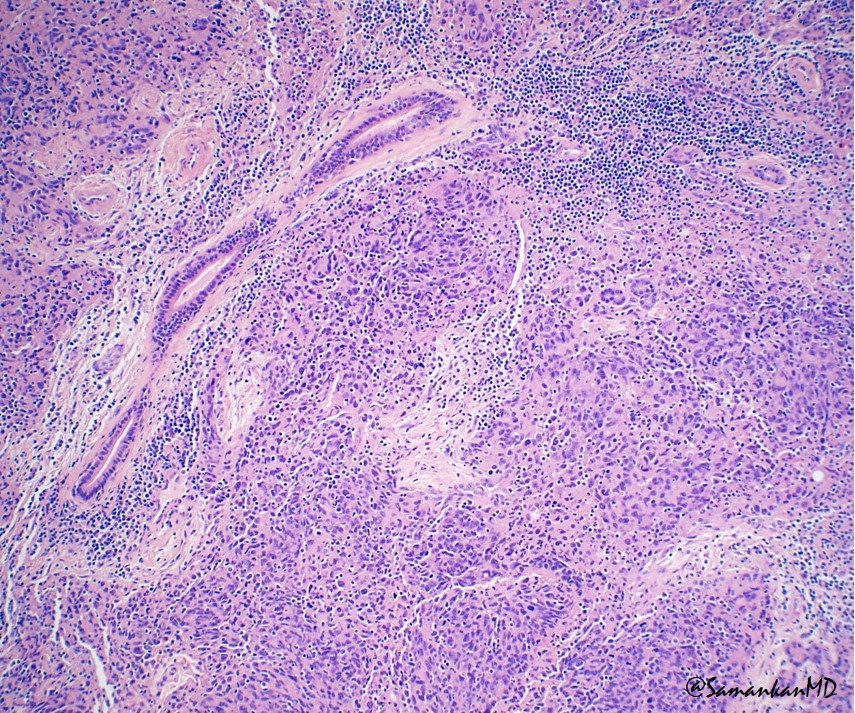 Shabnam Samankan tweet media