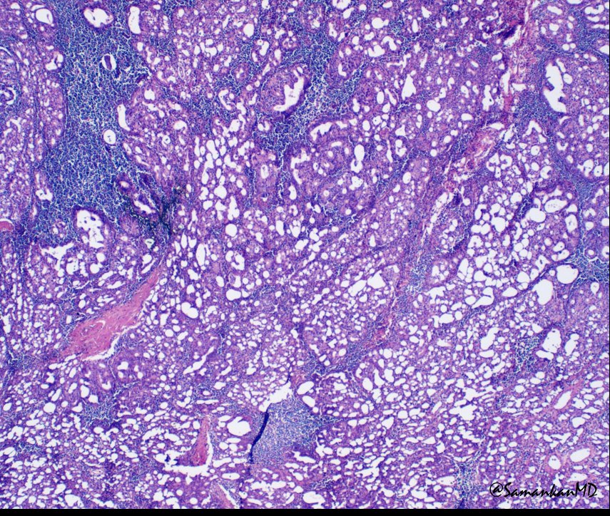 Shabnam Samankan tweet media