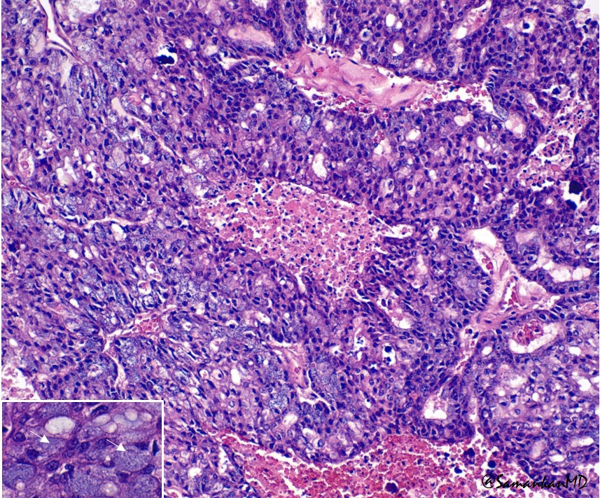 Shabnam Samankan tweet media