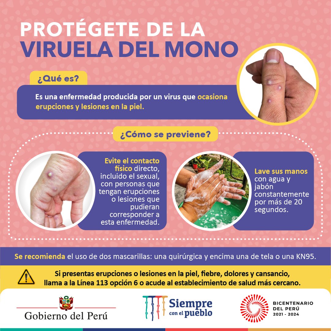 pcmperu's tweet photo. Vamos a prevenir la viruela del mono adoptando las siguientes recomendaciones. Recuerda esta enfermedad no es letal. #ViruelaDelMono https://t.co/ROrKliVxev