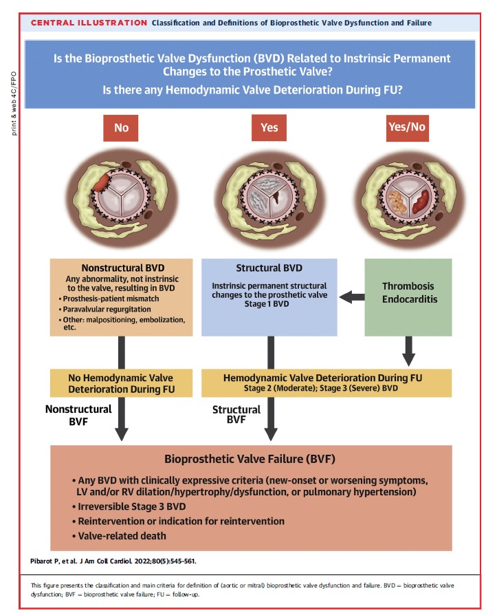 On behalf of Heart Valve Collaboratory, I am happy to announce that our paper on standardized definitions of structural valve deterioration for both aortic and mitral bioprosthetic valves is now published in JACC. <a href="/JACCJournals/">JACC Journals</a> 
From @jaccjournals jacc.org/doi/10.1016/j.…