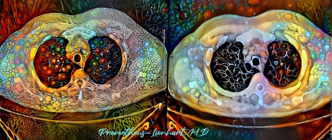 #Thoracic #art #radiology #artoflionhart