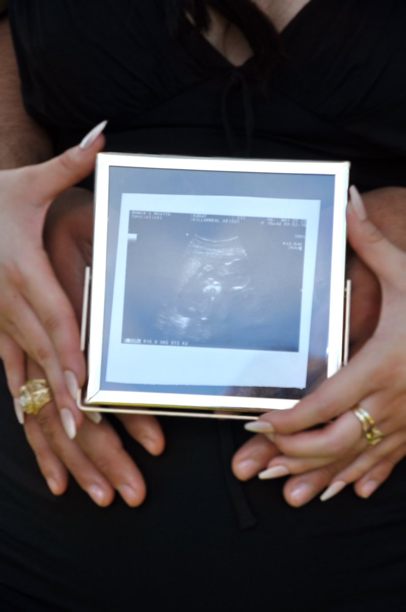 _vkeissyy's tweet photo. our family is growing by two little feet 🤍👣, babygirl coming November 2022 🎀 https://t.co/Pmuq7x28F3