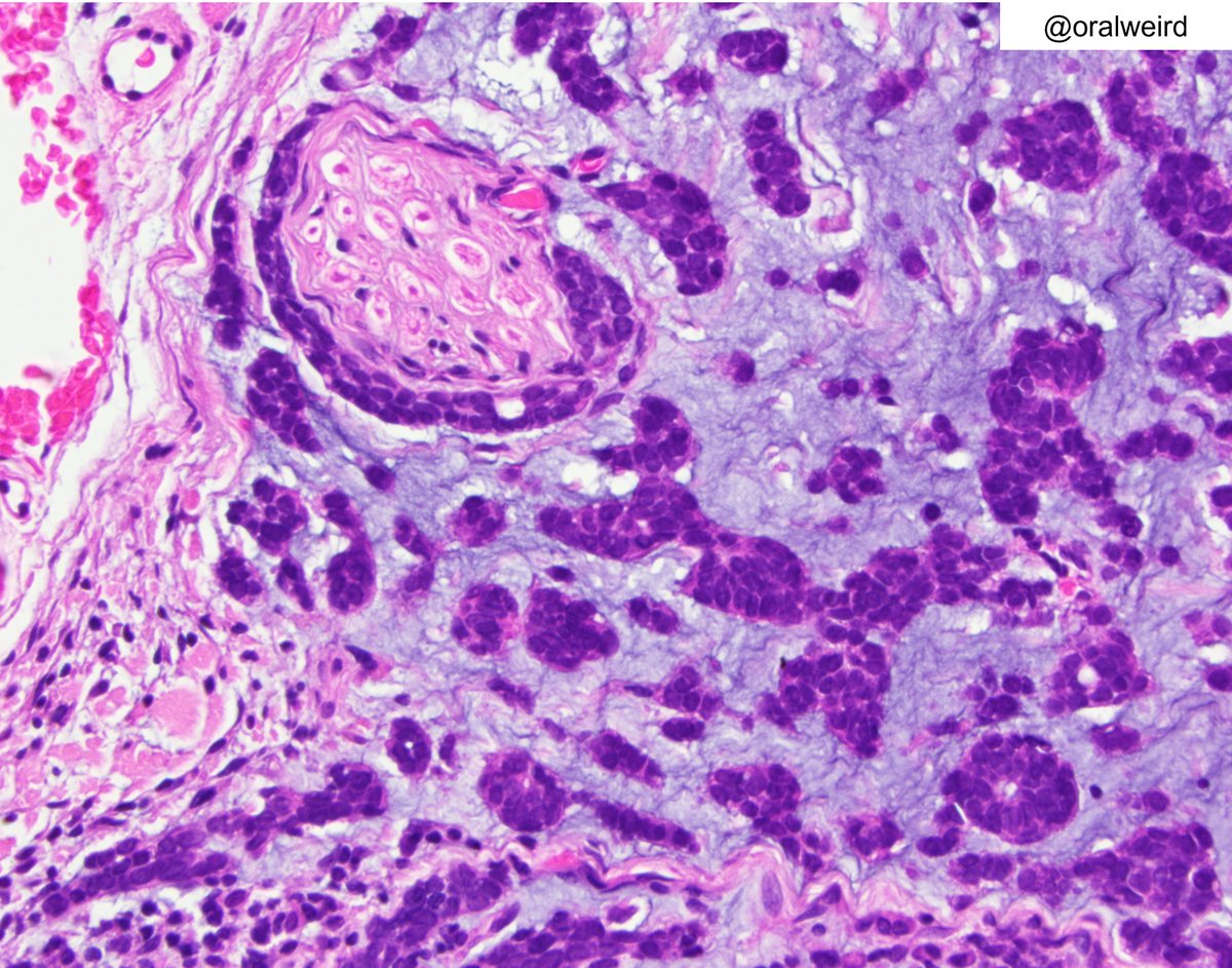 Oral Pathology "Weird & Wonderful" tweet media
