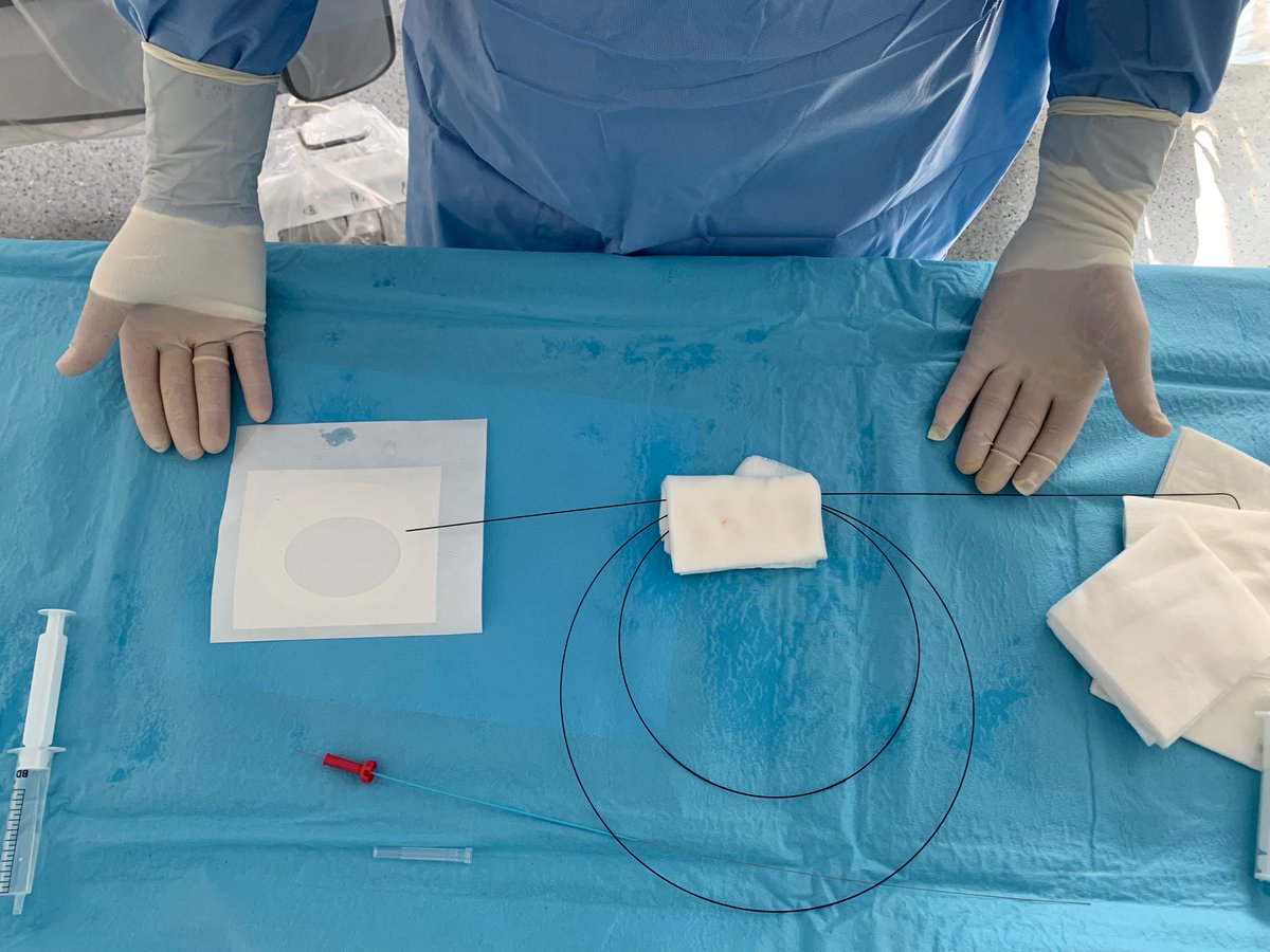 FelixValencia10's tweet photo. #Bleedless #slender 4Fr #radialfirst coronary angiography #rdTRA https://t.co/ldv5bwnxQz