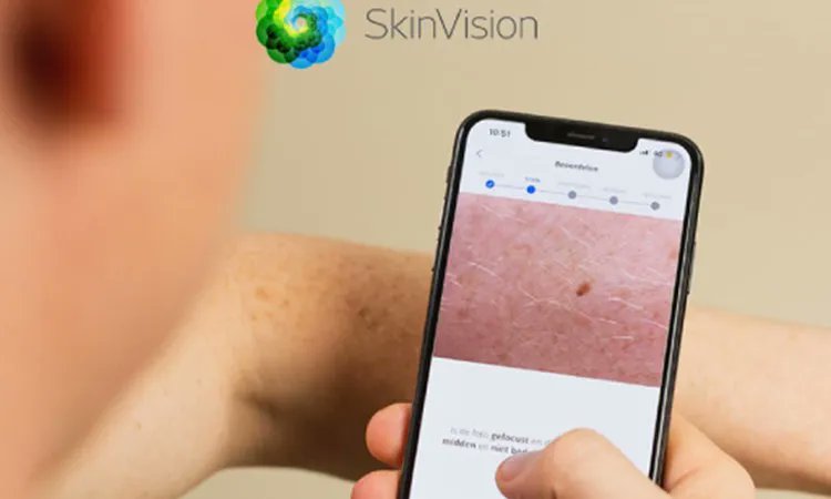 ☀️📱 Als je veel buiten werkt kunnen #huidklachten zich door de zon snel ontwikkelen. Daarnaast heb je een verhoogt risico op #huidkanker. Check jezelf regelmatig op verdachte plekken. Dat doe je makkelijk en snel met de #SkinVision-app ➡️ buff.ly/3NU7Abg #bouw #infra