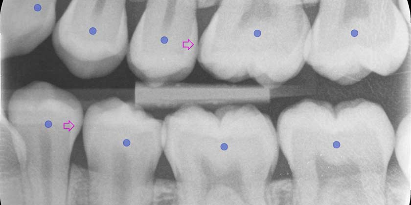 Clyde Munro Pilots AssistDent  -  lfr.news/3J6ITYy