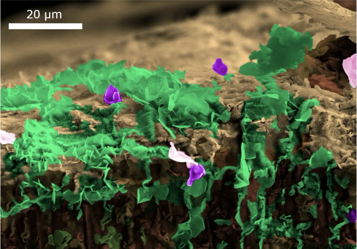 YoungCeramists's tweet photo. 🥉 The third place of the YCN Photo Contest and prize of 50 € goes to Ana Castellanos-Aliaga and David G. Calatayud for the picture named "Vertical Micro-garden" 👏 
Congratulations, Ana and David!!! 😊 
#YCNPhotoContest #PhotoContest #Micrograph #SEM https://t.co/SNi98GHdCT