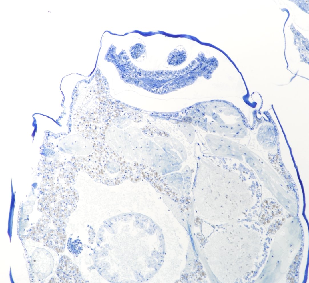 When you`re not happy with the results, but the results are happy with you. Leg happily regenerating inside the coxa of 𝘚𝘤𝘶𝘵𝘪𝘨𝘦𝘳𝘢 𝘤𝘰𝘭𝘦𝘰𝘱𝘵𝘳𝘢𝘵𝘢