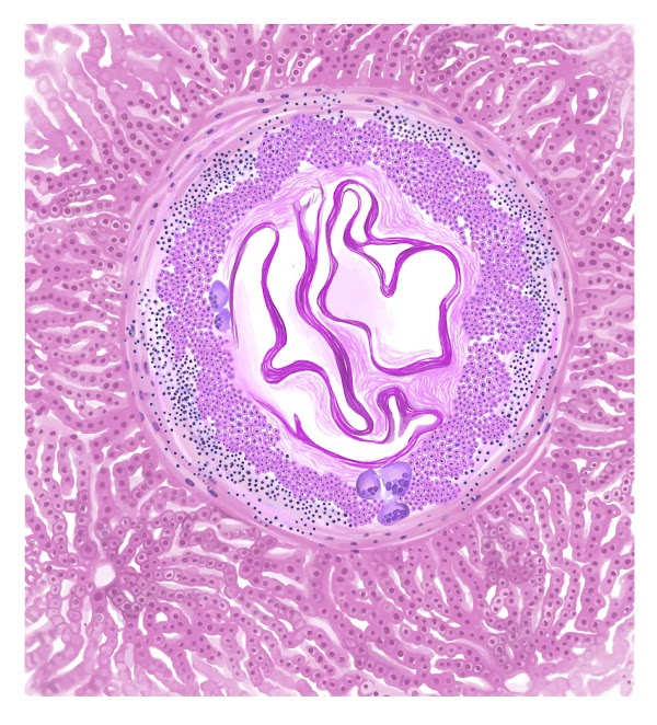 artsuvari's tweet photo. @TheCryptoTulip Echinococcus Hepatis'
0.006 $eth, polygon
https://t.co/FKxZsAUY3Z…
#nftart #NFTsales #nftcollectors #NFTs https://t.co/Esxh5eCdoX