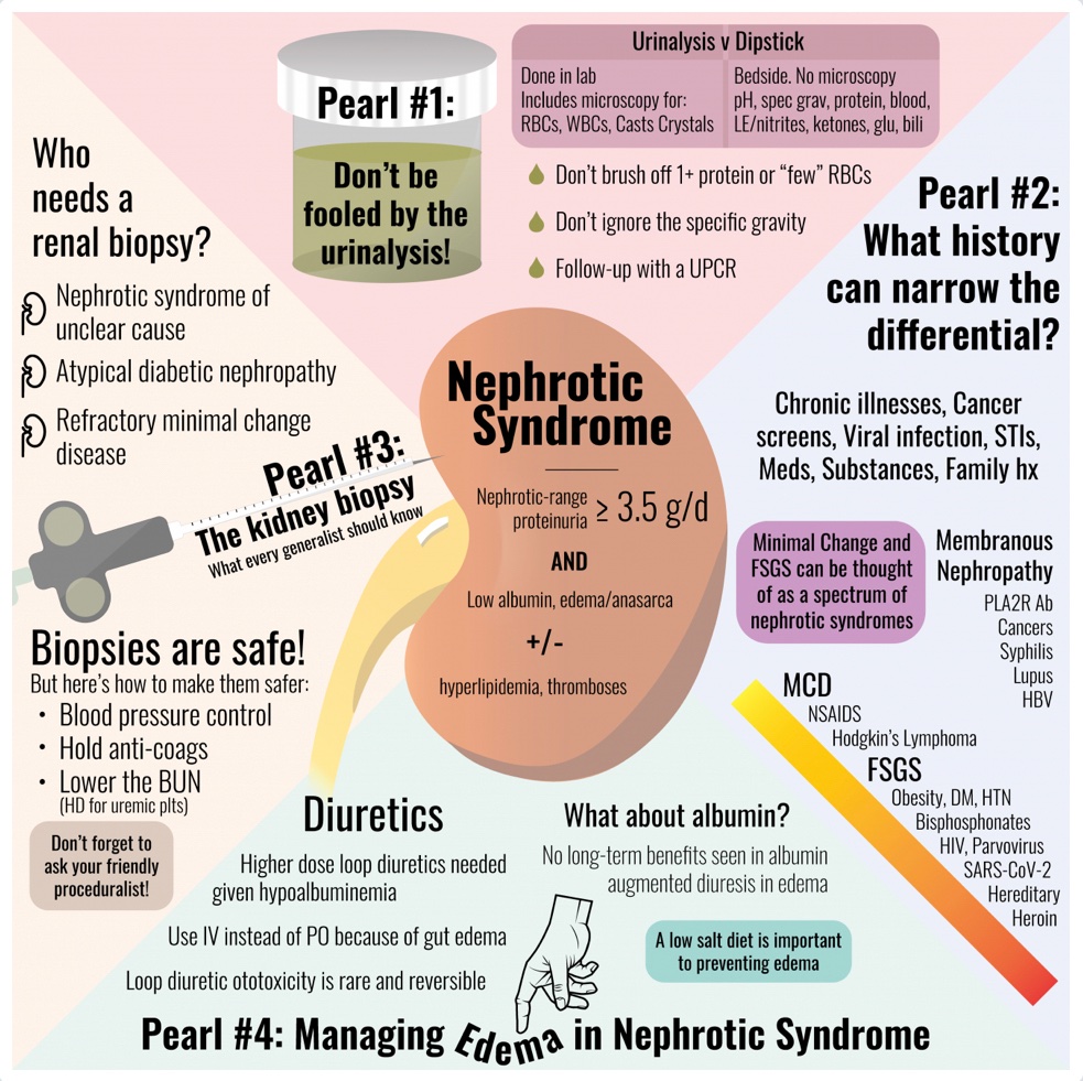 Nephrotic syndrome @COREIMpodcast #BJHM #Nephroticsyndrome #MedEd #Medtwitter #Renal #FOAMed #Medstudenttwitter