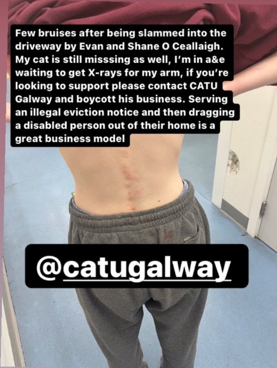 Galway CATU ⛵️ tweet media