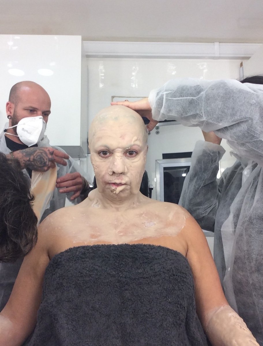 8. Becoming #MotherZero. Starting on the back which includes "George" the pulsating blob and his mechanics. #ResidentEvil #ResidentEvilNetflix #practicalfx #prosthetics