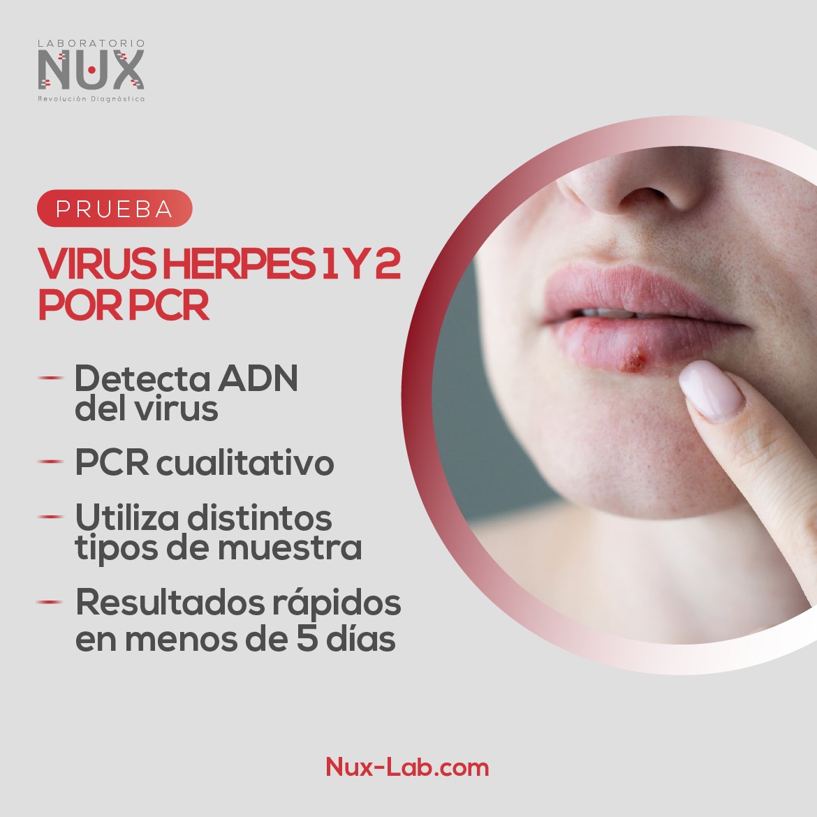 La prueba Virus Herpes 1 y 2 por PCR disponible en Nux Laboratorio 🧬

¿Tienes preguntas acerca de esta prueba? 
Escríbenos al 6644-6299 o llámanos al 373-5839

#nuxlaboratorio #herpes #deteccion #vhs #its #prueba #pruebaspanama #infeccion #infecciones #informateconNUX