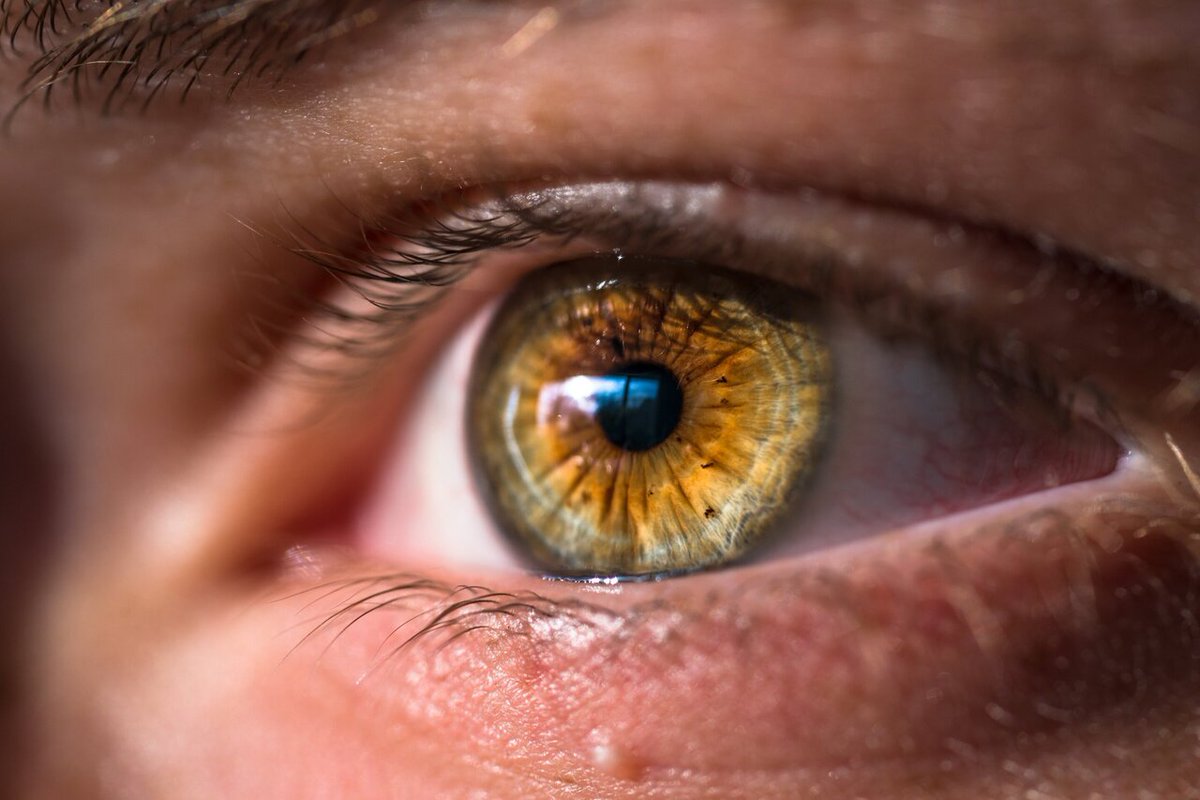 Web: …hthalmology.peersalleyconferences.com
Minimally invasive retinal reattachment procedure leads to superior photoreceptor integrity #eyeanatomy #Eyeallergy #eyeinfections #ophthamology #glaucoma #cortex #immunology #biochemistry #ocularoncology #retinalimaging #opticalvision #lensdisorders