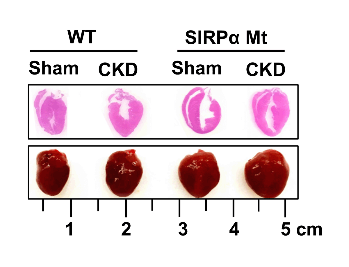 Thomas et al have identified that #SIRPα interferes with myocardial #insulin/#IGF1 receptor functions resulting in #CKD-induced #cardiomyopathy. Learn about novel targets for therapies to prevent #HF ahajrnls.org/3cDDgoy @HTaegtmeyer @GDavogustto
