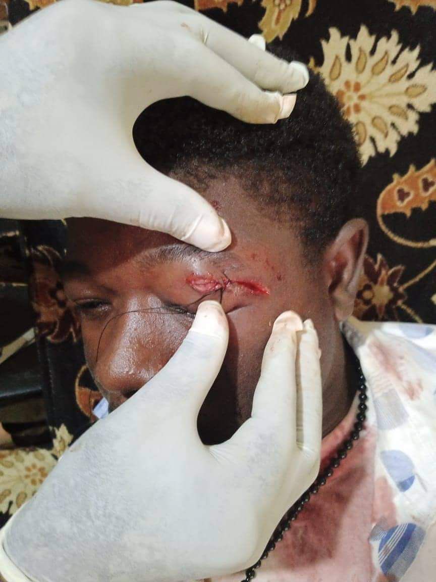 b_mawolo's tweet image. I strongly condemn the brutal beating of students and Christopher Walter Sisulu Sivili by the goons of CDC-COP.
#Fixthecountryprotest