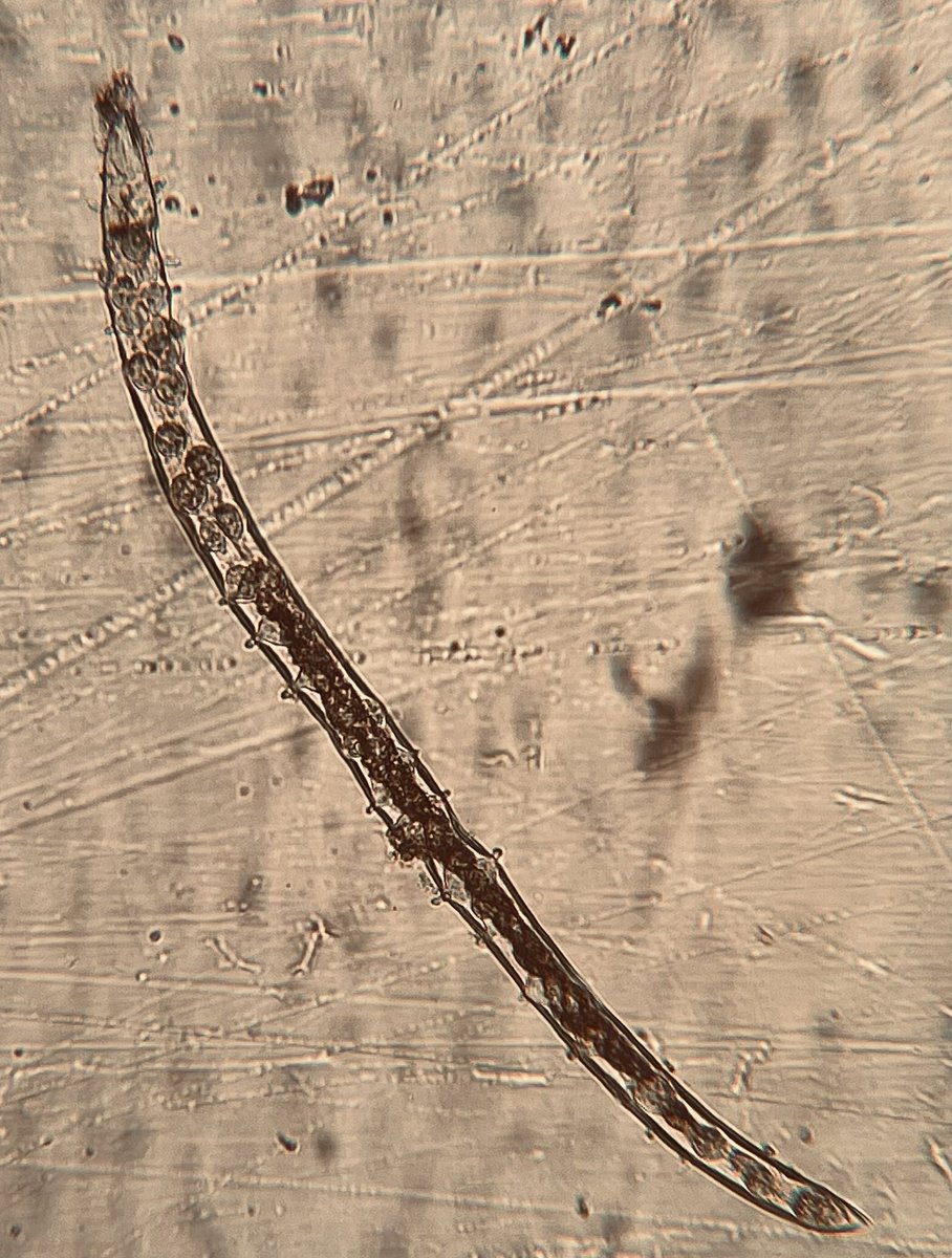 Lara_LLHAG's tweet photo. Cool find under the scope today…#nematodes #nematology #agscience https://t.co/8eLbgK667k