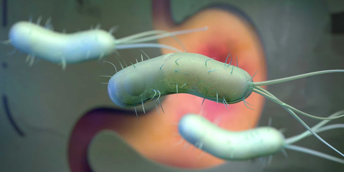 bpacnz (@bpacnz) on Twitter photo New article - H. pylori: who to test and how to treat
bpac.org.nz/2022/h-pylori.…
H. pylori is less prevalent in New Zealand compared to many other parts of the world, but is still a potential factor in people presenting with dyspepsia-like symptoms.
#dyspepsia #Gastroenterology New article - H. pylori: who to test and how to treat
bpac.org.nz/2022/h-pylori.…
H. pylori is less prevalent in New Zealand compared to many other parts of the world, but is still a potential factor in people presenting with dyspepsia-like symptoms.
#dyspepsia #Gastroenterology