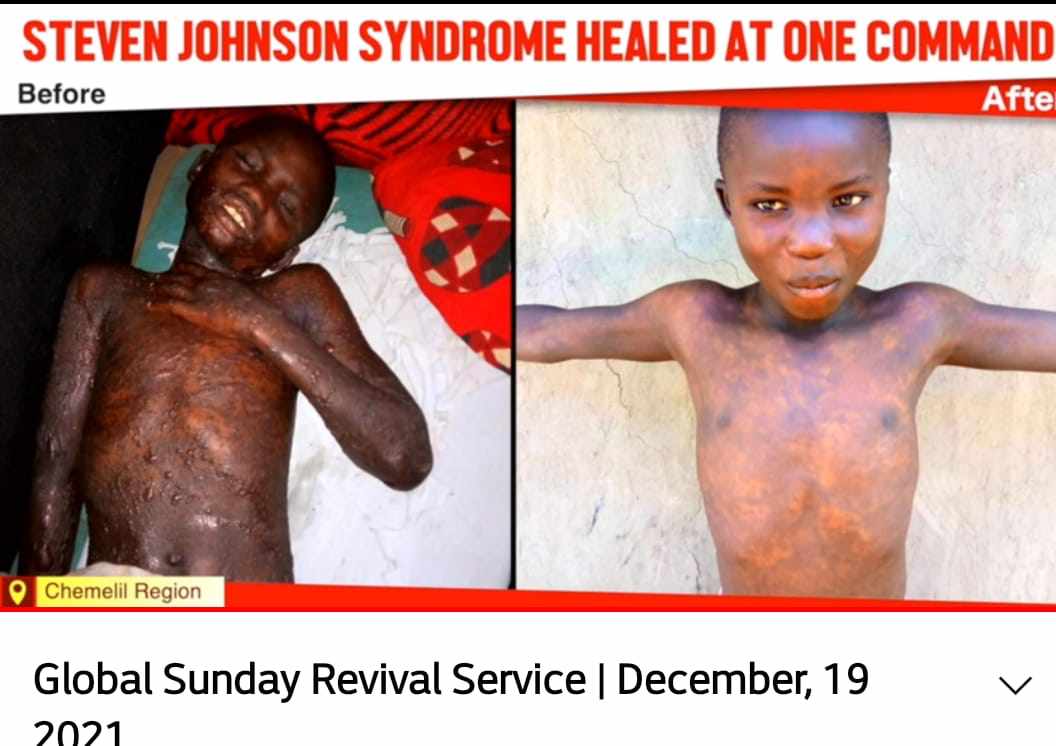faeFridah21's tweet photo. Lunacy ☑️ Healed.
Leprosy ☔ Cleansed.
Nations🌧️ Receive JESUS
Severe Skin condition 👉Healed.
Who can miss JAMHURI HEALING SERVICE, NAIROBI KENYA?
#RoadToMaputo@K24 https://t.co/CGO7gXJ8wS