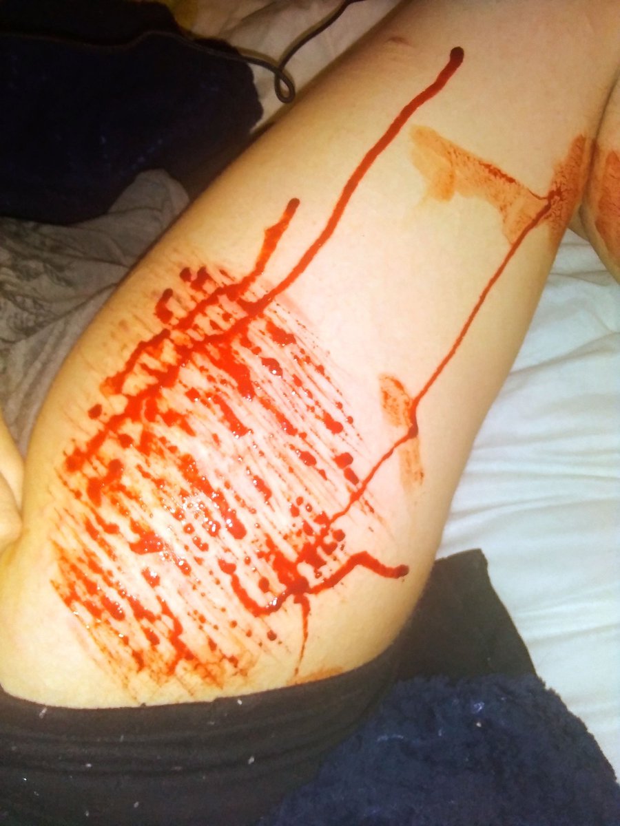 CatZomi's tweet photo. last pic is the healed version https://t.co/zv2DaSAtIJ