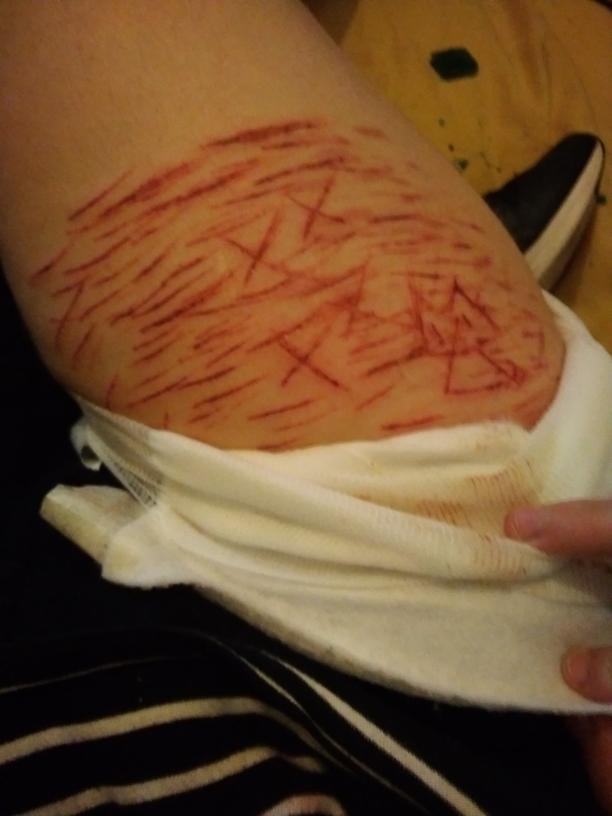 CatZomi's tweet photo. last pic is the healed version https://t.co/zv2DaSAtIJ