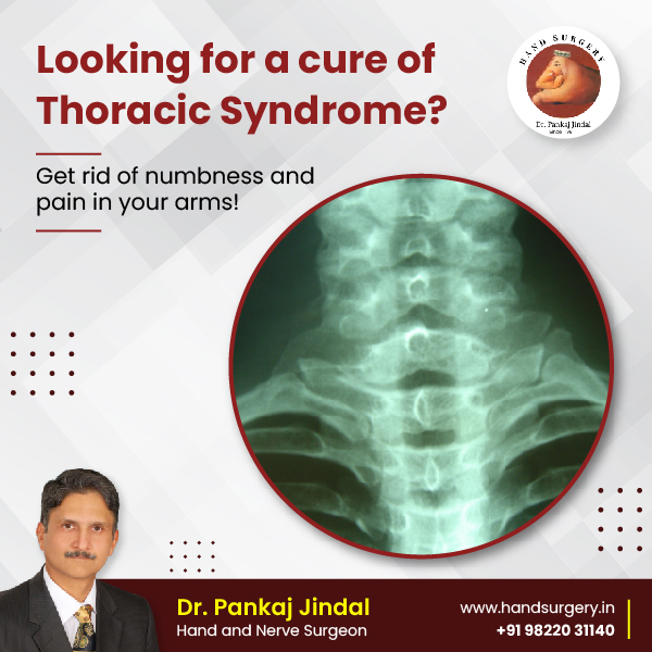 HandSurgeryInd's tweet photo. Athletes typically experience this issue in sports that require repetitive motions of the arm and shoulder. Visit Dr. Pankaj Jindal to get your treatment done with the best medical care available!

To book appointment, call on +91 98220 31140 or visit https://t.co/LSh01WrRql. https://t.co/jKmyKug702