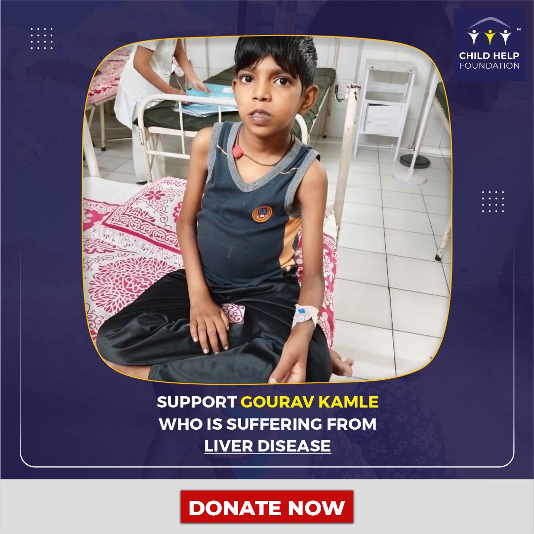 chfusa_'s tweet photo. Gourav Kamle is a 10-year-old boy from Madhya Pradesh who is suffering from #BiliaryAtresia. He has to undergo a liver transplant in Rela Hospital, Chennai. The treatment costs Rs. 22L. Please Help to save the little boy.
.
#ChildhelpfoundationUSA #Livertransplant https://t.co/oTOj9duG7K