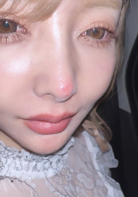 整形総額1000万モデルの 数百万かけた鼻 に悲劇 転んで強打 擦り傷に鼻血 不安しかない J Cast ニュース 全文表示