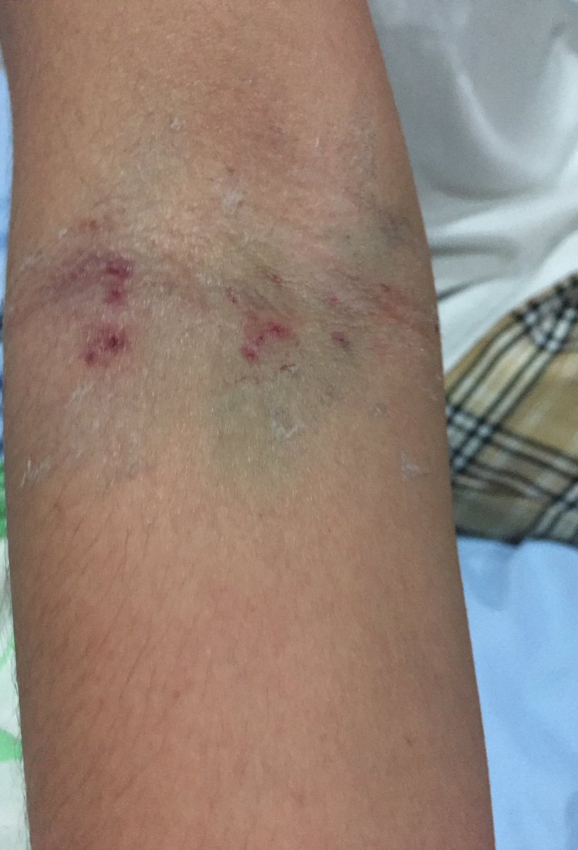 jh_mails's tweet photo. hello! it’s been a while and im really sorry for being inactive for the longest time. I got dengue when i went back to pampanga and got hospitalized for a week, i am still recovering but i feel so much better now. ++ https://t.co/DsxhmKQHYW