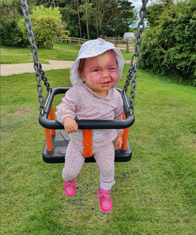 FaceEquality's tweet photo. "As a family, we don’t see Lily’s visible difference. We just see our beautiful little Lily. Having a birthmark doesn’t define you as a person – it’s what’s inside that counts."

Lily's story: https://t.co/KUgqebqP4a https://t.co/rdT0Tx3E0H